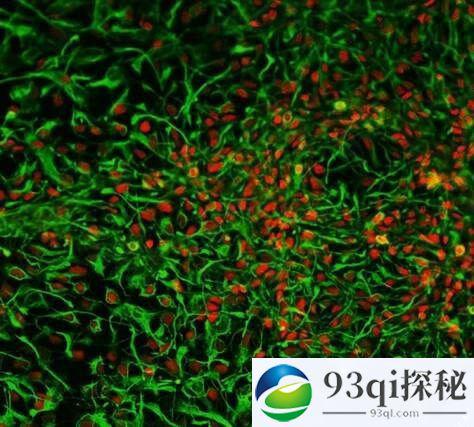 中国科学家利用尿液成功制造脑细胞