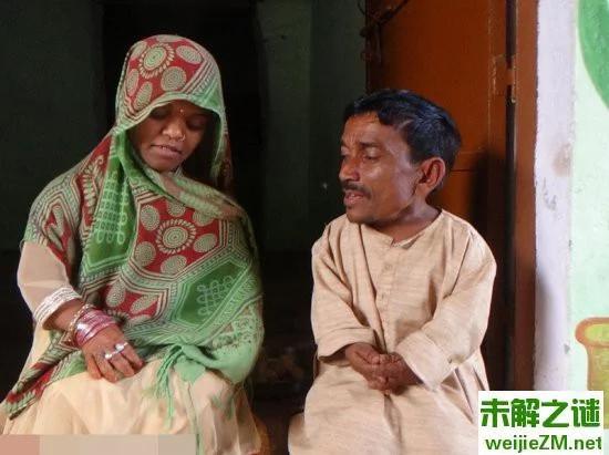 印度78厘米“小矮人”终成婚！妻子高1米