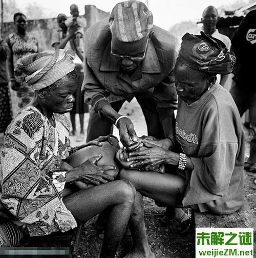 西非贝宁恐怖割皮仪式 留疤痕避免成为奴隶
