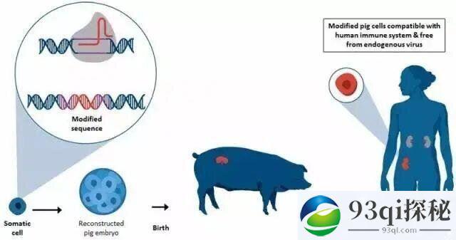 人类永生不是梦 最新研究猪肾成功植入人体