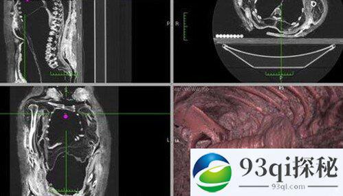 揭木乃伊制作鲜为人知的秘密 尸体保腐有机密