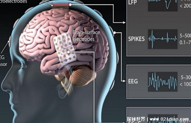 脑机接口实现了突破 思维信号被转化为语音